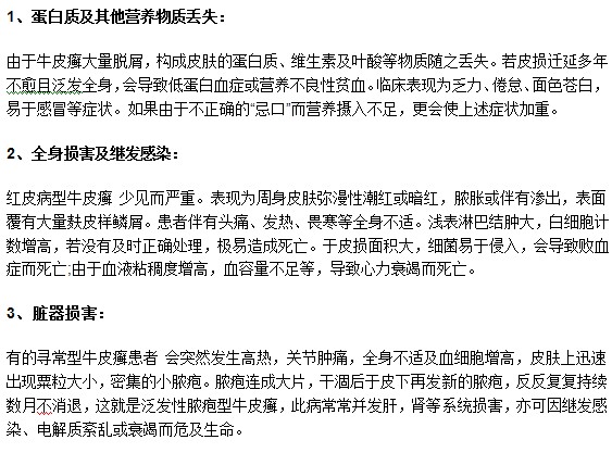 莫要忽視牛皮癬疾病，以下幾種危害你了解嗎？
