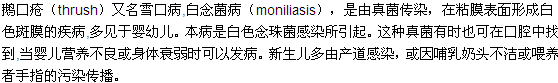 鵝口瘡