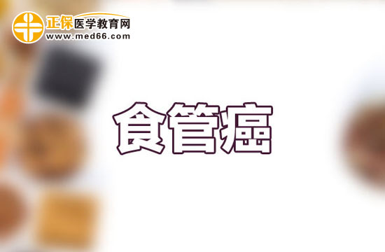 出現(xiàn)這五點(diǎn)癥狀表現(xiàn)要小心患上早期食道癌