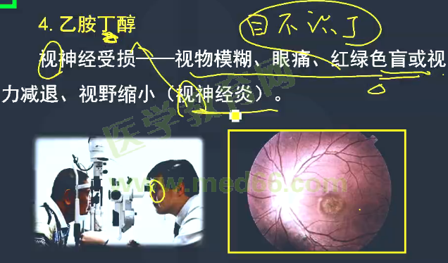 2017年醫(yī)學(xué)教育網(wǎng)課程與執(zhí)業(yè)藥師試題對比