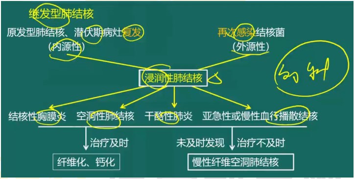 繼發(fā)型肺結(jié)核